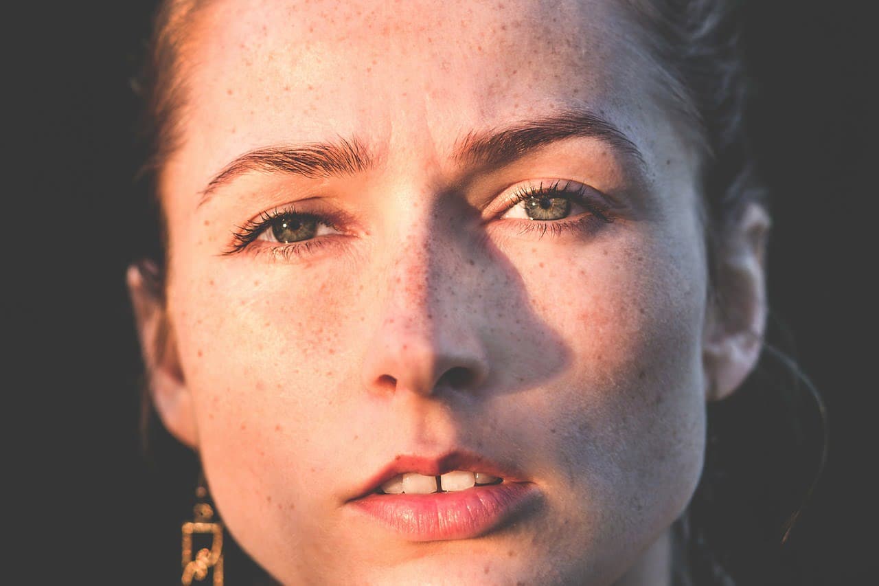 dream meaning Freckles