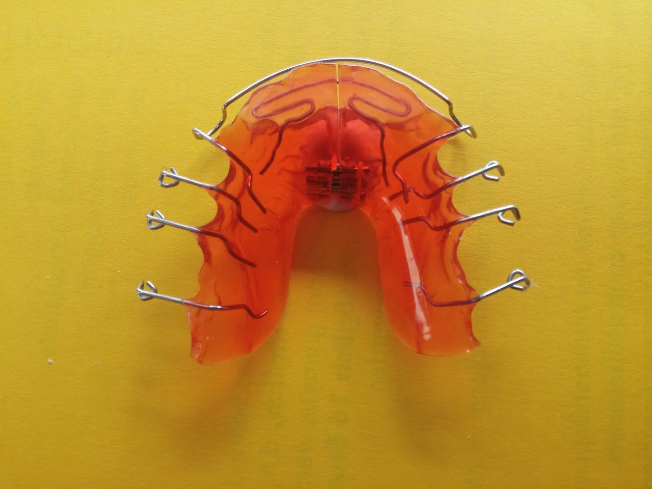 dream meaning Orthodontic Braces