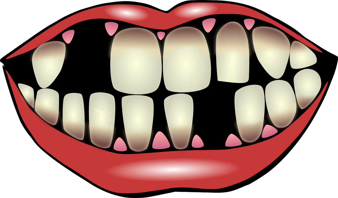 dream meaning Teeth Falling Out