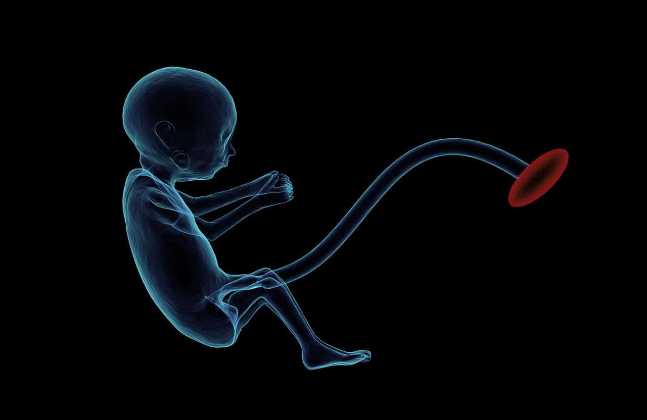 dream meaning Umbilical cord