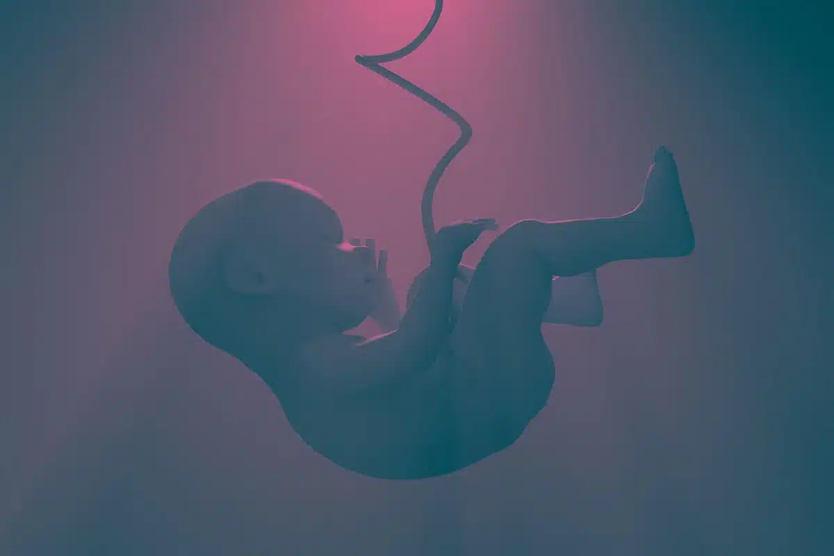 dream meaning Stillborn